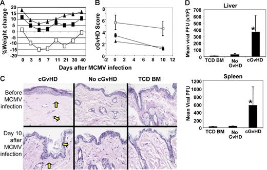 Figure 1. Evidence of cGvHD and antiviral immune response in recipients with untreated splenocytes. Irradiated CB6F1 recipients of 3 × 106 untreated donor splenocytes (cGvHD), 10 × 106 amotosalen-treated donor splenocytes (no-GvHD–treated splenocyte recipients), or TCD BM alone (no GvHD) were infected with MCMV (5 × 104 PFU intraperitoneally) on 100+ days after transplantation. (A) Percentage weight loss was calculated from the initial weight measured on day 0 of transplantation. Here, day 0 represents the percentage weight loss measured on day 133 after transplantation (□, cGvHD, splenocytes recipients; ▪, no GvHD; and ▴, TCD BM). (B) Recipients with cGvHD, no-GvHD–treated splenocyte recipients, and TCD BM were killed on day 100 after transplantation (day 0 after MCMV infection) and day 10 after 5 × 104 PFU MCMV infection. Skin, liver, and small intestine were collected in formalin solution and cGvHD scores were assessed from the histologic tissue sections of skin, liver, and small intestines. The average mean value and standard deviation of cGvHD scores obtained from the 3 organs of recipients with cGvHD (□), no GvHD (▪), and TCD BM (▴) on days 0 and 10 after MCMV infection. (C) The presence of sclerodermoid sclerosis and fibrosis (yellow arrows) is shown in the histologic slides of skin tissue sections collected from the recipients with cGvHD, no GvHD, and TCD BM under uninfected conditions (day 100 after transplantation) and day 10 after MCMV infection (day 110 after transplantation). The data are representative of 1 of 2 similar experiments and 4 to 5 mice were used per group in each time point. (D) Recipients with cGvHD, no GvHD, and TCD BM alone were infected with MCMV (5 × 104 PFU intraperitoneally) at 100 days after transplantation. Liver and spleen were aseptically collected on day 3 after infection and viral load per organs was determined by spreading the tissue homogenates on a 3T3-cell confluent monolayer as described in “Materials and methods.” Mean viral PFU and standard deviations obtained from each of the infected organs of 5 to 6 mice per group were used (*P < .001, Student t test).