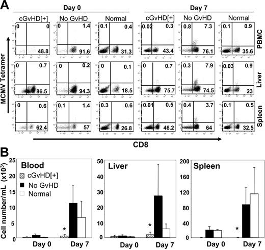 Figure 5. Immunosuppression associated with cGvHD responsible for the deficit antiviral T-cell responses. Allogeneic transplant recipient with cGvHD, syngenic transplant with no GvHD, and normal C57BL/6 mice were intraperitoneally vaccinated with 1 × 106 CFUs Lm-MCMV. Lymphocytes were harvested from the blood, liver, and spleen collected on days 0 and 7 after vaccination, and MCMV peptide–specific tetramer-positive CD8+ T cells were measured by FACS analysis. (A) Representative dot plots of donor spleen–derived tetramer-positive CD8+ T cells in the blood, liver, and spleen of recipients with cGvHD and no GvHD and CD3+-gated populations of normal C57BL/6 mice. (B) Absolute number of tetramer-positive CD8+ T cells per organ measured from the recipients with cGvHD, no GvHD, and normal C57BL/6 mice. *P < .05 in blood and liver and *P < .001 in spleen (Student t test) are for the decreased absolute numbers of MCMV peptide–specific tetramer-positive CD8+ T cells per organ in recipients with cGvHD compared with without GvHD or normal mice. Three to 5 mice were used per group in each time point.