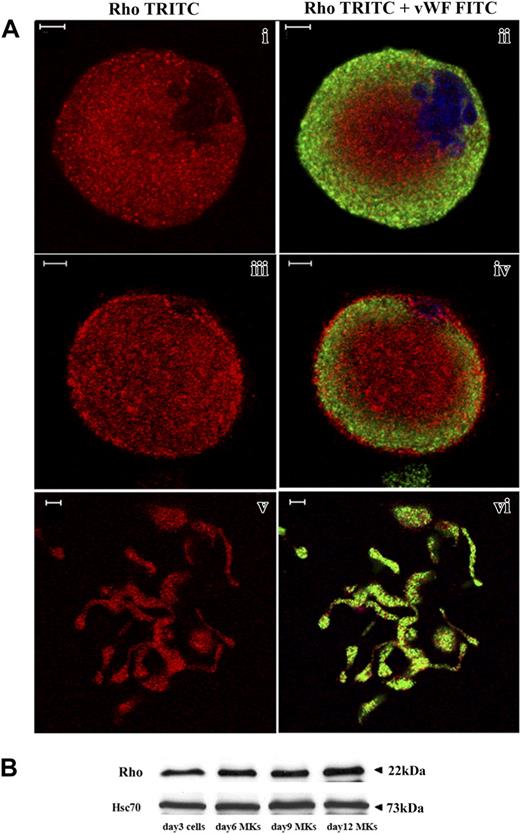 Figure 1. Rho expression during MK differentiation. CD34+ cells purified from blood leukapheresis were cultured in the presence of TPO. At day 6 and day 12 of culture, cells were dually stained with a VWF polyclonal antibody (green) and an anti-Rho mAb (red). (A) Rho was uniformly distributed all over the cytoplasm of mature MKs with a slight reinforcement along the plasma membrane (i-ii). Rho was distributed clearly along the plasma membrane in another MK suggesting an activation site (iii-iv). In MKs forming PPTs, Rho was localized all over the cytoplasm (v-vi). Bars represent 5 μm. (B) The level of Rho was studied by Western blotting using Hsc70 as the control. At day 3, Western blots were performed on total culture. In contrast, at days 6, 9, and 12, Western blots were performed with CD41+MKs.