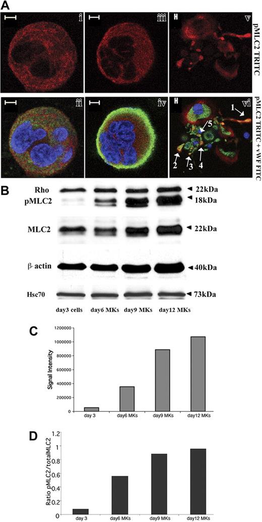 Figure 5. MLC2 phosphorylation status during megakaryocyte differentiation. (A) Immunolabeling was performed with an anti-pMLC2 (red), an anti-VWF (green), and a TOTO-3 iodide (blue). Photomicrographs were taken using a Zeiss laser scanning microscope equipped with a 63×/1.4 numerical aperture (NA) oil objective. pMLC2 was localized in the cytoplasm of immature (i-ii) and mature MKs (iii-iv). In MK-forming PPTs (v-vi), pMLC2 was localized along the cytoplasmic extensions (arrow 1), in the swellings (arrows 4 and 5), and in the tips of PPTs (arrows 2 and 3). Bars represent 5 μm. (B) CD34+ cells derived from leukapheresis were cultured 3 days with TPO, and one part of the cells was collected. Culture was continued, and CD41+ MKs were selected at day 5 as described in “Materials and methods” and grown for additional days with TPO. Western blots were performed on cells collected on day 3 and on MKs collected on days 6, 9, and 12. β-Actin, MLC2, and pMLC2 protein levels increased from day 3 to day 12. Rho was expressed at an almost constant level regardless of the MK differentiation stages. Anti-Hsc70 antibody was used as a control of protein loading. (C-D) Western blot quantification showed the increase in both pMLC2 (C) and pMLC2/MLC2 ratio (D) during MK differentiation.