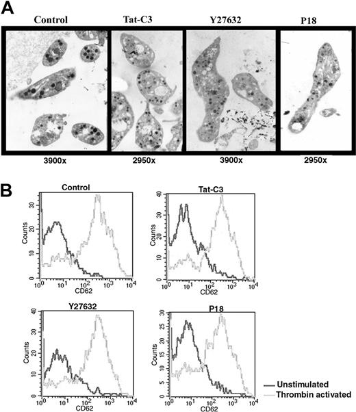 Figure 7. Structure and function of platelets produced in vitro in the presence of inhibitors of the Rho/ROCK pathway. (A) Platelets obtained with Y27632 or Tat-C3 or P18 display a normal ultrastructure under electron microscopy but an increased size compared to the untreated control. (B) Platelets produced in serum-free medium with or without inhibitors were activated by thrombin (2 U/mL) and analyzed by flow cytometry. Platelets produced with all 3 inhibitors display a normal response to thrombin activation.