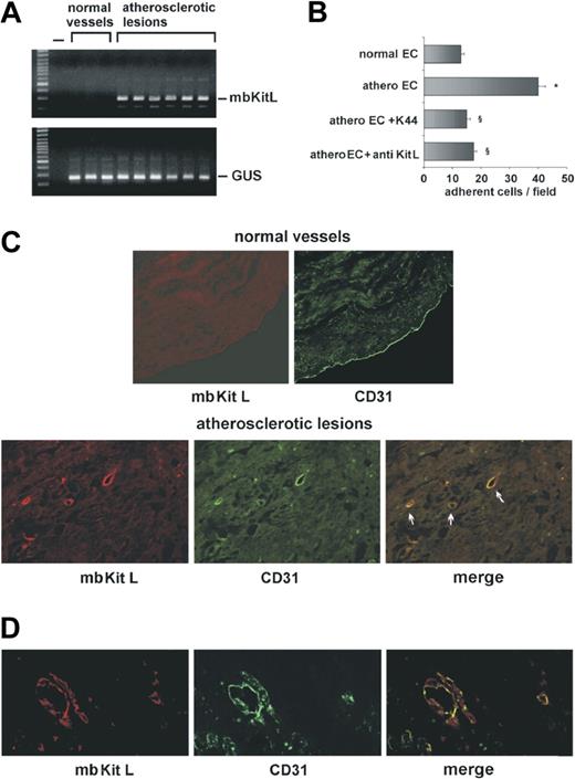 Figure 6. The mbKitL is expressed in vivo by inflamed endothelium and by neointima vessels. (A) RQ-PCR was performed on ECs derived from normal vessels or from different grade of atherosclerotic plaques. GUS gene was used to normalize the samples. (B) EPCs were let to adhere to ECs derived from normal or atherosclerotic vessels. In selected experiments, ECs from atherosclerotic plaques were pretreated with anti-KitL or EPCs were pretreated with K44. Adherent cells were counted and statistical analysis was performed (data are the mean ± SD; *P < .05 control vs experimental group: §P < .05 ECs from atherosclerotic vessels + anti-KitL or + K44 vs ECs from atherosclerotic vessels). (C) Specimens from normal vessels or atherosclerotic lesions were double immunostained with an anti-KitL or an anti-CD31 as primary antibody. TRITC- or FITC-conjugated goat anti–mouse IgG was used as secondary antibody, respectively. Colocalization of mbKitL and CD31 is represented in merge. Arrows indicated atherosclerotic vessels. Similar results were obtained with 6 different samples. (D) Representative immunofluorescence microscopy of Matrigel plugs containing human microvascular endothelial cells and TNFα (20 ng/mL) is reported. An anti-KitL or an anti-CD31 antibody was used as primary antibody. TRITC- or FITC-conjugated IgG was used as secondary antibody, respectively. Colocalization of mbKitL and CD31 in neoformed vessels is reported in merge. Four different sections per mice (4 mice) were analyzed.