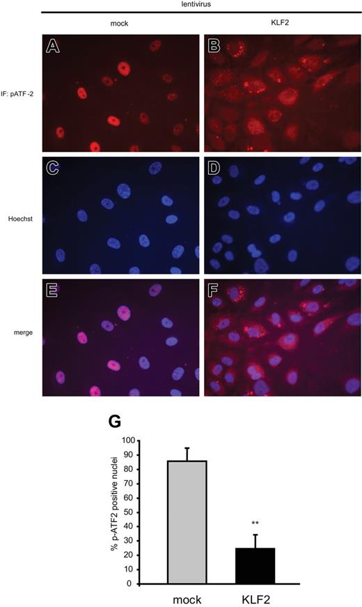 Figure 5. KLF2 suppresses nuclear localization of phosphorylated ATF2. HUVECs transduced with mock (A,C,E) or KLF2 (B,D,F) lentivirus were fixed with paraformaldehyde and stained for Thr71-phosphorylated ATF2 protein by immunofluorescence (A-B). Nuclei were made visible with a Hoechst nuclear staining (C-D), and the pictures were merged (E-F). Photographs representative for 2 independent experiments were obtained by fluorescence microscopy using a magnification of × 63. (G) Quantification was performed by counting nuclei with strong nuclear pATF2 positivity in 3 representative microscopic fields from mock- and KLF2-transduced cells taken from the 2 independent experiments, with each field containing an average of about 350 cells. **Significant difference in pATF2-positive nuclei between mock and KLF2 values (P < .01).