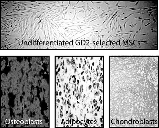 Figure 2. Ex vivo expansion and trilineage differentiation of GD2-selected MSCs. Photomicrograph of undifferentiated, ex vivo–expanded cells (upper panel) after isolation by GD2 selection. The characteristic spindle shape morphology and plastic adherence of MSCs is shown. Immunocytochemical staining (lower panels) demonstrates the differentiation of the GD2-selected MSCs into osteoblasts (Alizarin Red stain), adipocytes (Oil Red O stain), and chondroblasts (Alcian Blue stain).