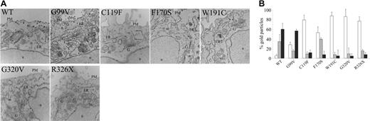 Figure 3. HJV mutants are retained into the ER. (A) HeLa cells were transiently transfected with mammalian vectors encoding WT and mutants HJV. At 18 hours after transfection, sections were stained with antibody against cMYC using nano-gold protocol as described in “Materials and methods.” Images were acquired using AnalySIS software (Soft Imaging System, Lakewood, CO). Original magnification, × 23 000. PM indicates plasma membrane; ER, endoplasmic reticulum; G, Golgi; m, mitochondria; and n, nucleus. (B) Morphometric analysis of WT and mutant HJV proteins showing the different distribution of the molecule in intracellular compartments. □ indicates ER; ⊡, Golgi apparatus; and ▪, plasma membrane. Error bars indicate SD.