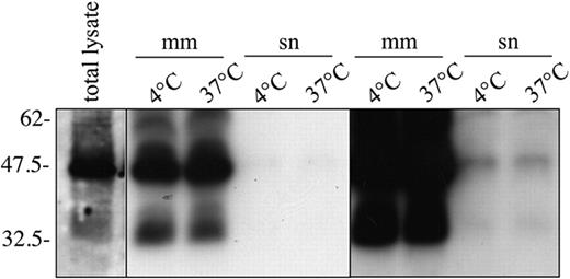 Figure 6. s-HJV does not originate from isolated membranes. Membrane fractions from WT HJV-transfected HeLa cells were incubated for 18 hours at 4°C and 37°C and centrifuged; the corresponding supernatants and membrane pellets were separated by 10% SDS-PAGE under reducing conditions. Right panel shows the same overexposed film. Proteins were revealed using anti-HJV. mm indicates microsomal membranes; sn, supernatant. The relative molecular mass, in kilodaltons, is indicated on the left.