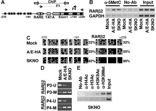 Figure 4. AML1/ETO induces epigenetic modification of the RARβ2 gene in t(8;21)-positive cells. (A) Schematic representation of the distribution of the CpGs (black circles) along the promoter and exon 1 (nt 370 to +238) of the RARβ2 gene. The black arrows indicate the DNA sequences amplified by different sets of primers sensitive to the methylation status of CpGs (P3 and P4). White arrows indicate the regions of annealing of the PCR primers used in ChIP assays. (B) ChIP analysis was performed in mock, A/E-HA, and SKNO-1 cell lines using an antibody specific for 5-methylcytosine (α-5MetC) or with no antibody (no-Ab) as negative control. Immunoprecipitated chromatins were analyzed by PCR primers specific for the amplification of a genomic region containing the βRARE binding site and the 5′-UTR exon 1 of RARβ2 gene. Samples representing 0.02% of sonicated chromatin (input) were included in the PCR analysis. The amplification of a GAPDH coding region was performed as a control of nonspecific precipitated sequences. (C) Bisulfite sequencing assay was performed to detect the methylation status of each CpG along the RARβ2 promoter/exon 1 sequence on genomic DNA isolated from mock, A/E-HA, and SKNO-1 cells. Black (▪) and empty (□) squares represent methylated and unmethylated CpGs, respectively. For each sample, the percentages of global methylation level in the promoter and in the 5′-UTR exon 1 regions are indicated. (D) MSP PCR assay was performed on bisulfite-treated DNA isolated from mock, A/E-HA, and SKNO-1 cell lines to analyze the methylation status of RARβ2 promoter/exon 1 regions. U and M indicate the unmethylated and methylated forms amplified by MSP primers, respectively. (E) ChIP assay was performed on the SKNO-1 cell line using antibodies specific for the acetyl-H4, acetyl-H3, acetyl-H3-Lys9, and methyl-H3-Lys9 forms or without antibody (no-Ab) as a negative control.