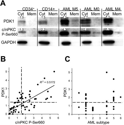 Figure 7. PDK1 and phospho-PKC are overexpressed in patients with AML. (A) Western blot data from normal bone marrow subpopulations and AML blasts fractionated into cytosolic and membrane components. Figures show expression levels relative to normal CD34+ bone marrow cells for which representative data are shown (n = 4); see also note Figure 4. (B) Quantitative analysis of total PDK1 and phospho-PKC expression in AML blasts (normalized to mean expression in CD34+ cells; n = 5). Dashed lines indicate statistical threshold of normal expression (mean ± 2 SD of normal CD34+ cells). (C) Expression of PDK1 related to AML FAB subtype.