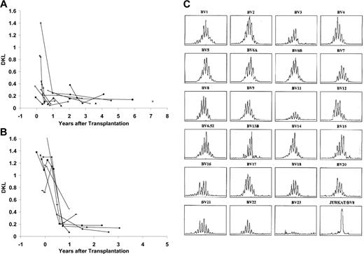Figure 3. CD4 TCRBV repertoire diversity as assessed by spectratyping. (A) DKL values for 16 subjects with typical complete DiGeorge anomaly. (B) DKL values for 7 subjects with atypical complete DiGeorge anomaly. (C) CD4 spectratyping profiles for subject DIG005 at 7 years after transplantation. The Jurkat control panel is in the lower right. The DKL value for this spectratype is 0.11.