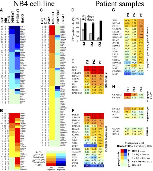 Figure 1. Transcriptional activities of APL blasts displaying different sensitivities to ATRA in vitro. Within the subset of SAGE tags that matched genes with described functions and that were registered according to the HuGO nomenclature, the abundances of SAGE tags from a proliferative NB4 library (UnT) were compared with their respective levels in both ATRA-treated NB4 (Diff) and polymorpho-nuclear neutrophil (PMN) libraries. Variations (P values) were calculated between proliferative NB4 cells and cells induced to differentiate by a 48-hour exposure to 1 μM ATRA (Diff/UnT). The proliferative NB4 library was also compared with the granulocytes (PMN/UnT). By mining NB4 gene expression data relative to the granulocytic phenotype, 48 underexpressed genes (A) were separated from 35 up-regulated genes (B). A cluster of 75 retinoid-induced genes that were barely detectable in the granulocyte but clearly induced by retinoid during NB4 cell differentiation (C). Heterogeneity at day 3 in the differentiation of 3 APL blasts (NBt test) exerting distinct sensitivities to ATRA (D). Data from the Relative Quantity gene expression (RQ) analysis. Transcriptional modulation (Log10 RQ) was calculated for blasts treated for 3 days with ATRA (0.1 μM) in comparison with an untreated control. Clusters of retinoid-responsive genes (E), granulocytic markers (F), chromatin remodelers, transcription factors, and coregulators (G). Genes involved in retinoic acid metabolism and the inflammatory response to maturation (H).