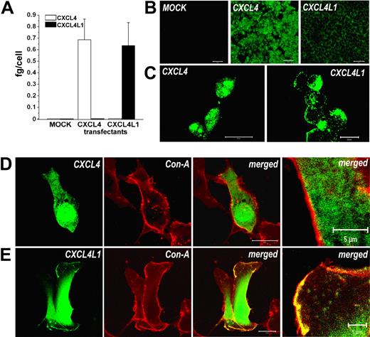 Figure 2. CXCL4 and CXCL4L1 expression by HEK-293 and HMVEC transfectants. (A) CXCL4 and CXCL4L1 mRNA expression by HEK-293 transfectants, as assessed by real-time qRT-PCR. Columns represent mean values (± SEM) of 10 selected clones. (B) Expression of CXCL4/CXCL4L1 in HEK-293 transfectants, as detected by immunofluorescence. Absence of signal in mock transfectants (left), strong cytoplasmic signal in CXCL4 transfectants (green, middle panel), staining in a region adjacent to plasmatic membrane in CXCL4L1 transfectants (green, right). Bar represents 50 μm. (C) High-power magnification of immunofluorescence performed on CXCL4 (left) or CXCL4L1 transfectants (right). Bar represents 20 μm. (D) Confocal microscopy of HMVECs transfected with CXCL4-GFP. GFP fluorescence (green) was localized in the cytoplasm; concanavalin A stains the membrane (red). Merged image (yellow) demonstrates absence of coexpression; bar represents 20 μm. At the extreme part of the figure a high-power magnification of a detail of the merged image is shown; bar represents 5 μm. (E) Confocal microscopy of HMVECs transfected with CXCL4L1-GFP. GFP fluorescence (green) was localized in the cytoplasm and on cytoplasmic membrane, as demonstrated by merged image (yellow; bar represents 20 μm). At the extreme part of the figure a high-power magnification of a detail of the merged image is shown (bar represents 5 μm). Images in panels B and C were acquired using an LSM 510 Meta confocal microscope (Zeiss) equipped with a 20 ×/0.50 NA Plan-Neofluor objective lens (Zeiss). Images in panel D and E were acquired using an LSM 510 Meta laser scanning confocal microscope equipped with a 40×/1.30 NA oil Plan-Neofluor objective lens. An electronic zoom is shown in the extreme panel. LSM 510 Meta confocal microscope software version 3.0 (Zeiss) was used to capture all the images.
