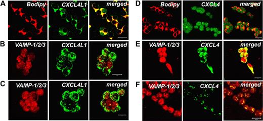 Figure 5. Different intracellular localization of CXCL4 and CXCL4L1 in HEK transfectants. (A) Strong expression of CXCL4L1 (green) in the Golgi of CXCL4L1-HEK transfectants, as shown by costaining with the Golgi marker Bodipy (red). Colocalization is shown in yellow (bar represents 20 μm). (B) Virtually absent colocalization between the DCG marker VAMP-1/2/3 (red) and CXCL4L1 (green) in CXCL4L1-HEK transfectants. Colocalization is shown in yellow (bar represents 20 μm). (C) Absence of any effect of PMA treatment in CXCL4L1-HEK transfectants on CXCL4L1 (green) distribution and localization (bar represents 20 μm). (D) Marginal colocalization of CXCL4 (green) with the Golgi marker Bodipy (red) in CXCL4-HEK transfectants. Colocalization is shown in yellow (bar represents 20 μm). (E) Localization of CXCL4 (green) within DCGs in CXCL4-HEK transfectants, as demonstrated by strong costaining with the DCG marker VAMP-1/2/3. Colocalization is shown in yellow (bar represents 20 μm). (F) Treatment of CXCL4-HEK transfectants with PMA for 6 hours induces degranulation of CXCL4-containing DCGs. Colocalization of CXCL4 (green) within DCGs of CXCL4-HEK transfectants, as stained with VAMP-1/2/3 is shown in yellow (bar represents 20 μm). Images were acquired using an LSM 510 Meta confocal microscope (Zeiss) equipped with a 20×/0.50 Plan-Neofluor objective lens (Zeiss). LSM 510 Meta confocal microscope software version 3.0 (Zeiss) was used to capture all the images.