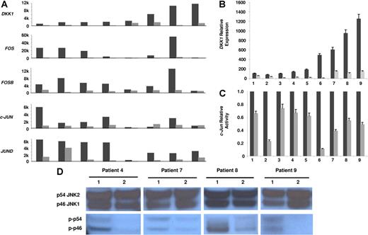 Figure 1. Osteoclasts down-regulate DKK1 and JNK pathway components in myeloma plasma cells. Primary myeloma plasma cells were cultured in the presence (⊡) or absence (▪) of osteoclasts for 2 days. (A) Microarray analysis was used to determine expression of DKK1, FOS, FOSB, c-JUN, and JUND in 8 samples with high baseline DKK1 expression (expressed as Affymetrix signal, 1000-unit increments). (B) DKK1 expression was evaluated by real-time PCR in another 9 samples cultured with (⊡) or without osteoclasts (▪), expressed as relative values using ΔΔCt method. (C) c-Jun–binding activity was evaluated in nuclear extracts of the same 9 samples of myeloma plasma cells shown in panel B, using an ELISA-based assay (expressed as relative value compared to each control). In panels B and C, each sample is expressed as the mean ±SEM of 2 duplicates. (D) The level of activation of the JNK pathway was determined by Western blot analysis for the phosphorylated isoforms of p46 JNK1 (p-p46) and p54 JNK2 (p-p54) in cytosolic extracts of 4 samples shown in panel C that had sufficient quantities of protein extracts available. Number 1 represents control samples; number 2 represents samples after osteoclast cocultures. Note that the modulation in JNK pathway activation is not due to variation in total levels of the JNK isoforms.