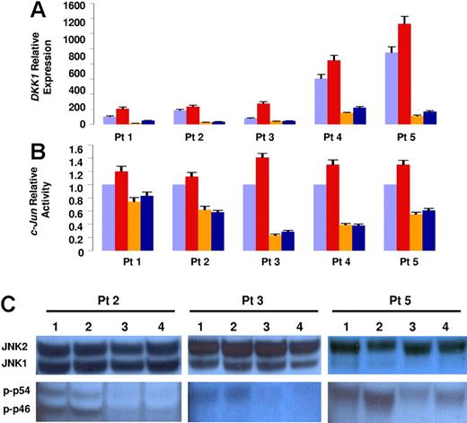 Figure 4. Osteoclasts counteract lenalidomide-induced DKK1 up-regulation. Five primary myeloma plasma cell samples were cultured with or without osteoclasts for 2 days in the absence (orange and violet bars, respectively) or in the presence of lenalidomide (blue and red bars, respectively). (A) DKK1 relative expression was evaluated by real-time PCR; (B) c-Jun binding activity was evaluated in nuclear extracts. In panels A and B each sample is expressed as the mean ± SEM of 2 duplicates. (C) The level of JNK pathway activation was determined by Western blot analysis of JNK phosphorylated isoforms in cytosolic extracts of 3 representative samples. Number 1 represents samples cultured without osteoclasts; number 2, samples treated with lenalidomide; number 3, samples cultured with osteoclasts; and number 4, samples cultured with osteoclasts in the presence of lenalidomide.