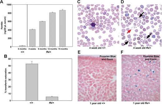 Figure 4. Serum ferritin and iron accumulation in ffe/+ mice. (A) Ferritin levels were measured in serum obtained from 3 6-month-old control mice and from 2 to 3 ffe/+ mice of the specified age. (B) Serum transferrin saturation was measured in 2 6-month-old control mice and 4 6-month-old ffe/+ mice. Samples from each mouse were measured in triplicate and the data from mice of similar ages were pooled. The error bars represent standard error of the mean. (C,D) Blood smears from 4-week-old +/+ mice (C) and ffe/+ mice were stained with Wright-Giemsa. Red arrow indicates hypochronic red blood cells; black arrows, target cells. (E,F) Sections of liver from 1-year-old wild-type (+/+) and ffe/+ mice stained with Prussian Blue to visualize accumulated iron. Image was taken using a Zeiss Axiophot2 using a 40× Plan Neofluar air objective with a 0.74 numerical aperture (CarlZeiss, Thornwood, NY). Image was captured using a Photometrics CoolSNAPfx camera (Image Processing Solutions, North Reading, MA) and IPLab Advanced Image Analysis Software Version 3.9.5r3 (BD Biosciences, Rockville, MD). Subsequent image processing was done using Adobe Photoshop 7.0 software (Adobe Systems, San Jose, CA).
