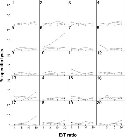 Figure 3. Transgene-specific effectors are present at low frequency in a healthy donor. PBMCs containing 2 × 106 CD3+ lymphocytes isolated from the donor of patient 2 were stimulated, in 20 independent microcultures, with autologous GMCs. On day 10, lytic activities of the lymphocytes were measured against SFCMM2-transduced (○) and untransduced (●) autologous GMCs as well as allogeneic T cells (□) in a standard chromium-release assay at the indicated E/T ratios. As shown, an immune response specific for the transduced cells was detected in microculture 6.