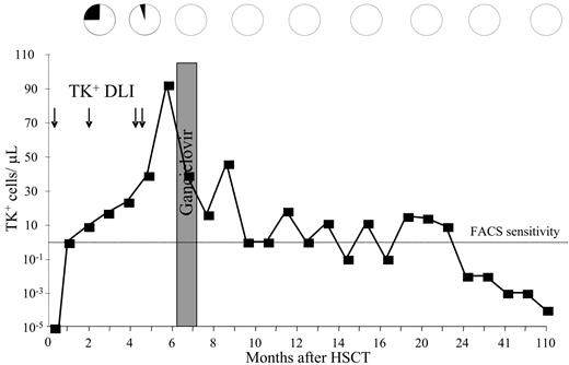 Figure 2. Kinetics of disease response in a patient with CMML following TK+ DLI. Patient 8, affected by chronic myelomonocytic leukemia (CMML) in relapse after allogeneic HSCT, was treated with multiple TK+ DLI (arrows). Absolute numbers of circulating TK+ cells, quantified by FACS analysis, are shown as ■. Below the level of FACS sensitivity, quantitative PCR values are reported. Percentage of malignant cells in the bone marrow (black sectors of pies) was assessed by analyses of host karyotype and quantification of myelodysplastic precursors. Disease response strictly correlated with the kinetics of expansion of TK+ cells and persisted after ganciclovir administration for cGvHD. TK+ cells were detectable by PCR during a complete remission long-term follow-up up to 110 months.