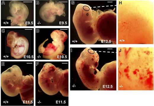 Figure 1. Hemorrhages in embryos lacking endothelial survivin. Survivinlox/lox (A,C,E,G) and tie1-cre/survivinlox/lox (B,D,F,I) embryos were examined at E9.5 to E12.5. Embryos lacking endothelial cell survivin (B,D,F,I) exhibit evidence of vasodilatation and diffuse bleeding in the head, trunk, and intersomitic regions, and around the heart. Scale bars equal 1.0 mm. (H,J) High-power view (× 10) of the surface of the head of the embryos in panels G and I, respectively, reveals the extensive microvascular bleeding in the tie1-cre/survivinlox/lox embryos.