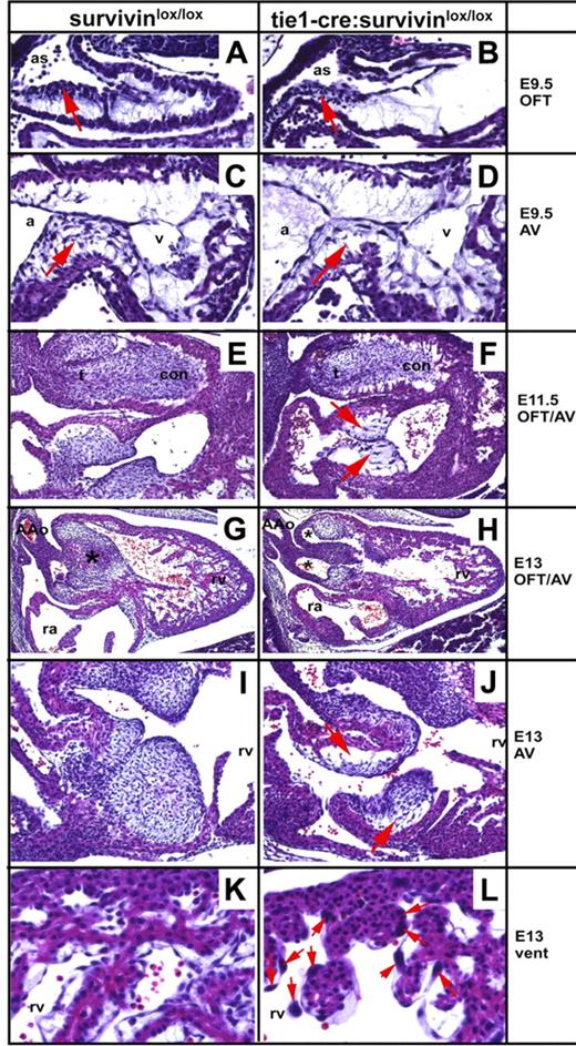 Figure 3. Hypoplastic endocardial cushions in embryos lacking endothelial survivin. Transverse histologic sections of survivinlox/lox (A,C,E,G,I,K) and tie1-cre/survivinlox/lox (B,D,F,H,J,L) embryos were examined at E9.5 to E13.0. Both wild-type and mutant E9.5 embryos exhibit the start of cardiac neural crest colonization of the OFT (arrows in A-B). Embryos lacking endothelial cell survivin exhibit reduced E9.5 AV EMT (arrow in panel D) that subsequently results in sparsely seeded, undersized AV cushions that are detached from the adjacent myocardium (F,J). Note the few enlarged endocardial cushion mesenchymal cells in hypoplastic E11.5 mutant AV cushions (arrows in panel F). Endocardial-EMT in the OFT is also affected and results in hypoplastic conal cushions (F,H). The E13 tie1-cre/survivinlox/lox OFT mesenchymal septum is undersized and misaligned, and exhibits double outflow right ventricle (DORV), as both the future pulmonary trunk and aorta exit the right ventricle (indicated by 2 stars in panel H), instead of the aorta exiting the left ventricle and the pulmonary trunk exiting the right ventricle (indicated by 1 star in panel G). The survivin-deficient endothelium overlying the E13 cardiomyocytes and endocardial cushions is abnormal, as there are fewer endothelial nuclei and many of the remaining nuclei are grossly enlarged (arrows in panel L). a indicates common atria; AAo, aortic arch; as, aortic sac; con, conal OFT cushions; t, truncal OFT cushions; ra, right atria, rv, right ventricle; and v, common ventricle.