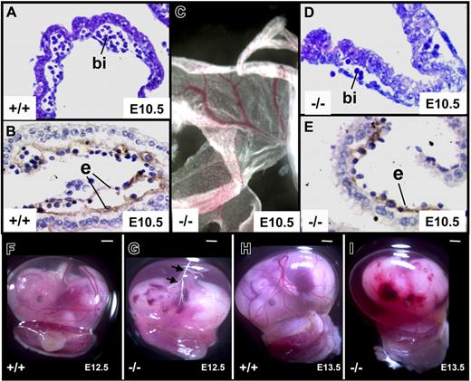 Figure 4. Yolk sac vessels, blood islands, and placenta. Sections of yolk sac vessels from survivinlox/lox (+/+) (A-B) and tie1-cre/survivinlox/lox (−/−) (D-E) were stained with H&E (A,D) and antithrombomodulin antibodies (B,E). While the vasculature of the −/− yolk sacs appeared remarkably grossly intact (C), histologic studies (D-E) revealed several areas with discontinuities of the flattened endodermal endothelial layers (e), and blood islands (bi) that were smaller and with fewer hematopoietic precursor cells. (F-I) At E12.5, branching yolk sac vessels were detectable in +/+ and −/− embryos, but they were frequently empty of blood in the −/− embryos (vessels marked with white line and arrows in panel G), and this was most often associated with a pale placenta. By E13.5, all −/− embryos that were detected were nonviable and resorbing (I). Scale bar equals 1 mm (G-I).