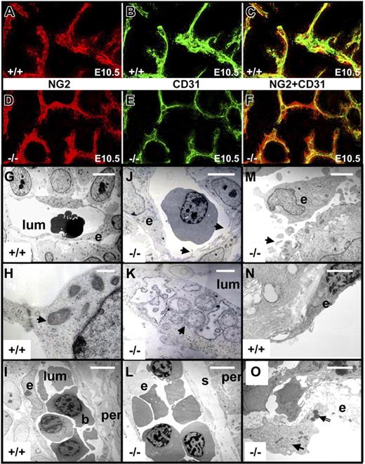 Figure 5. Structural studies of brain microvasculature in E10.5 embryos. Transverse sections of nonhemorrhagic brains from survivinlox/lox (+/+) and tie1-cre/survivinlox/lox (−/−) E10.5 embryos were cut at the level of the midbrain and stained with pericyte-specific NG-2 antibodies (A,D) and endothelial-specific CD31 antibodies (B,E), and the confocal images were overlaid (C,F). There was less intense CD31 staining in −/− embryos, with evidence of a gap between the endothelial and pericyte layers (F) compared with the +/+ (C) embryos. Transmission EM was used to examine brain microvessels (G-M) and yolk sac vessels (N-O) of survivinlox/lox (+/+) and tie1-cre/survivinlox/lox embryos. The endothelial cells (e) lining blood-filled (b) vessel lumens (lum) in +/+ embryos were smooth, continuous, and without gaps; contained normal mitochondria (arrow in panel H); and were immediately adjacent to surrounding pericytes (per) (I). In contrast, endothelial cell surfaces of −/− embryos were discontinous (arrows in panel J), with luminal and abluminal vesicles (arrow in panel M) and fragments of endothelial cells extending into the lumen (M), with strikingly abnormal and swollen mitochondria (arrow in panel K), and a wide space(s) between pericytes and endothelial cell layers (L). Compared with yolk sac vessels from +/+ embryos (N), yolk sac vessels from −/− embryos (O) were comprised of endothelial cells with attentuated plasma membranes, dilated endoplasmic reticulum (arrow in panel O), and nuclear chromatin condensation (double-stemmed arrow in panel O). Scale bar indicates 5 μm for panels G, J, I, and L; 2.5 μm for panel M; and 1 μm for panels H, K, N, O.