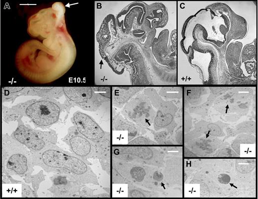 Figure 6. NTDs and TEM studies of brains of E10.5 embryos. (A) Representative E10.5 tie1-cre/survivinlox/lox embryo (−/−) with exencephaly (arrow). Scale bar indicates 1 mm. (B-C) Sagittal sections of the head of E10.5 embryos stained for H&E, showing exencephaly (arrows) in −/− embryo. (D-H) Survivinlox/lox (+/+) and tie1-cre/survivinlox/lox (−/−) embryo sections were examined by EM. Neural cells with mitotic figures (arrows in panels E-F) or apoptotic bodies (arrows in panels G-H) were frequently seen in the hindbrains of −/− embryos but not in those of +/+ (D) embryos. Scale bar indicates 2 μm for panels D-H.