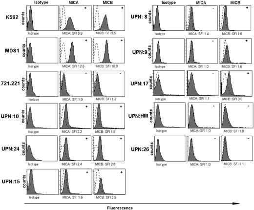 Figure 4. MICA and MICB expression on K562, MDS1, and 721.221 cell lines and on CD34+ bone marrow cells from MDS patients. Flow cytometry histograms for MICA/MICB expression on K562 cells, 721.221 tumor cells, and MDS1 cells. Isotype control expression (dotted line) was compared with samples stained with an equal amount of anti-MICA or anti-MICB antibody (solid line). Histograms represent results from individual patients (UPN). SFI was calculated using the equation described in “Patients, materials, and methods,” and specific value is shown in the histograms. The determination of positive (+) or negative (-) was based on an SFI value of at least 1.5 (indicated in the upper right hand corner of the histograms).