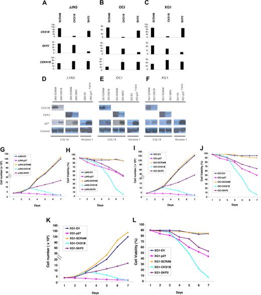Figure 2. Effects of silencing CKS1B or SKP2 and overexpressing a nondegradable form of p27Kip1 on MM cell growth and survival. CKS1B, SKP2, and CDKN1B (p27Kip1) mRNA expression was evaluated by microarray analysis 5 days after lentiviral infection in (A) JJN3, (B) OCI-MY5, and (C) XG-1 cells expressing a nonspecific scrambled shRNA (SCRAM), CKS1B shRNA, or SKP2 shRNA. All experiments were performed in duplicate, and the results were expressed as the mean ± standard error. Western blot analysis on nuclear fractions of the same aliquots of cells shown in panels A, B, or C confirmed that CKS1B shRNA and SKP2 shRNA efficiently inhibited CKS1B and SKP2 protein expression, respectively, and increased p27T187A levels in (D) JJN3, (E) OCI-MY5, and (F) XG-1. Cullin 1A (Cul1A) expression was used as control for the specificity of CKS1B and SKP2 action. p27T187A overexpression was confirmed in all 3 cell lines 5 days after lentiviral infection, compared to the control cells infected with an empty vector (EV). Histone 1 was used as a loading control. Effects of CKS1B or SKP2 shRNA and p27T187A overexpression on (G,I,K) cell proliferation and (H,J,L) cell viability in (G-H) JJN3, (I-J) OCI-MY5, and (K-L) XG-1. Total number of cells and cell viability were evaluated every day after lentiviral infection by trypan blue exclusion. Error bars represent standard error of the mean for 2 independent experiments.