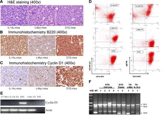 Figure 2. Histopathologic and immunohistochemical characteristics of the DTG lymphomas in relation to the B-cell lymphomas in parental IL-14α TG and c-myc TG mice. (A) H&E-stained paraffin sections (original magnification, × 400). (B) Sections stained with anti-B220 (original magnification, × 400). (C) Sections stained with anti–cyclin D (original magnification, × 400). DTG tumor staining is more uniform and intense than that of the c-myc TG tumor. IL-14α TG tumor is negative. (D) Flow cytometry of tumors from IL-14α TG, c-myc TG, and DTG mice showing CD19/CD5 and CD19/sIgM staining. (E) Semiquantitative RT-PCR of C57/BL6 spleen and tumors from IL-14α TG, DTG, or c-myc TG mice analyzed for cyclin D1 and actin, as described in “Patients, materials, and methods.” (F) Immunoglobulin gene rearrangements performed on tumors from IL-14α TG, c-myc TG, and DTG mice showing monoclonality of all of these tumors, as described in “Patients, materials, and methods.”