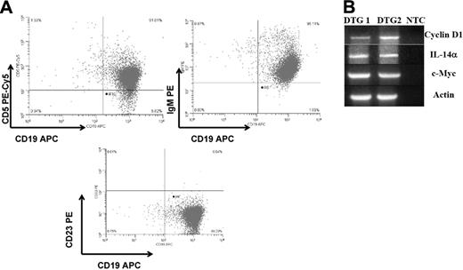 Figure 3. Characteristics of tumor cell lines derived from DTG mice. (A) Flow cytometry evaluating CD19/CD5, CD19/sIgM, and CD19/CD23. (B) Semiquantitative RT-PCR evaluating cyclin D1, IL-14α, and c-Myc, as described in “Patients, materials, and methods.”