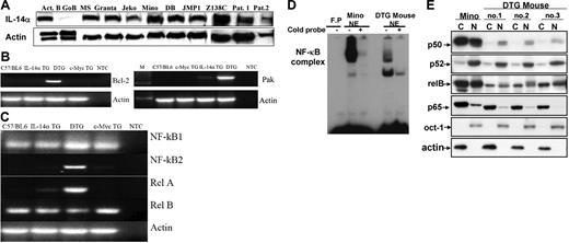 Figure 5. Gene expression in MCL-BV. (A) Demonstration of IL-14α expression in MCL-BV cell lines and fresh tumors from various patients, performed as described in “Patients, materials, and methods.” (B) Semiquantitative RT-PCR analysis of bcl-2 and Pak expression in spleen from C57BL/6 mice, and tumors from IL-14a TG, DTG, and c-Myc TG mice, performed as described in “Patients, materials, and methods.” NTC indicates negative control (no primers). (C) Expression of NF-κB components in the lymphoma of a DTG mouse. Total RNA purified from the indicated mouse was analyzed for NF-κB1, NF-κB2, p65, and RelB by semiquantitative RT-PCR. (D) Translocation of NF-κB to the nucleus in DTG lymphoma cells. EMSA analysis was performed as described in “Patients, materials, and methods” using nuclear extracts purified from Mino cells or DTG lymphoma cells. FP indicates free probe. (E) Cytoplasmic and nuclear extracts were purified from Mino cells or 3 different cell lines derived from the lymphoma of DTG mouse and analyzed for NF-κB components by Western blotting as described in “Patients, materials, and methods.”
