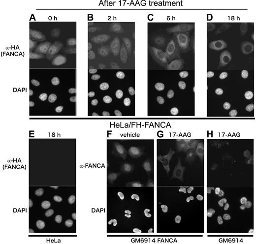 Figure 4. 17-AAG induces cytoplasmic relocalization of FANCA. HeLa/FH-FANCA cells (A-D) and control HeLa cells (E) were treated with 250 nM 17-AAG for the indicated times, and then stained with anti-HA antibody. GM6914 cells stably expressing wild-type FANCA (GM6914/FANCA) were cultured with vehicle (F) or 250 nM 17-AAG (G) for 18 hours, and then stained with anti-FANCA antibody. As a control, GM6914 cells treated with 250 nM 17-AAG for 18 hours were stained with anti-FANCA antibody (H). For optimal visualization of fluorescence signals, exposure time was adjusted. Cell nuclei were visualized with DAPI staining. Images were obtained on an Olympus AX70 microscope equipped with UPlan Apo 20×/0.70 NA and WH10×/22 lenses (Olympus, Tokyo, Japan) using a PXL charged-coupled device camera (model CH1; Photometrics, Osnabruck, Germany).