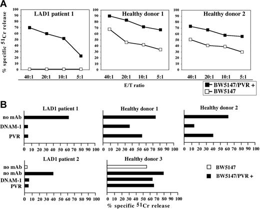 Figure 5. Analysis of the DNAM-1–induced cytolytic activity in IL-2–activated LAD1 NK cells. (A) IL-2–activated NK cell populations derived from LAD1 patient 1 and from 2 representative age-matched healthy donors were analyzed for cytolytic activity against BW5147 murine cell line either untransfected or transfected with the PVR molecule (BW5147/PVR+) at different E/T ratios. (B) IL-2–activated NK cell populations from LAD1 patients and from representative age-matched healthy donors were analyzed for cytolytic activity against BW5147 cell line untransfected (white bar) or PVR transfected (black bars) either in the absence of mAb or in the presence of mAbs specific for the indicated molecules. The E/T ratios used were 20:1 for LAD1 NK cell populations, 5:1 for healthy donor 1, 10:1 for healthy donor 2, and 5:1 for healthy donor 3. The results are representative of 3 independent experiments; the standard deviation of the mean of the triplicates was less than 5%.