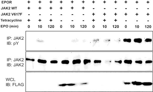 Figure 3. SOCS3 differentially affects growth signals from JAK2 V617F. Ba/F3 cells expressing EPOR with either JAK2WT or JAK2 V617F and SOCS3 regulated by tetracycline removal (-) were incubated in cytokine-free medium for 4 hours, stimulated with EPO (100 U/mL) for 10 minutes, washed and incubated for 120 minutes in cytokine-free medium. Lysates were immunoprecipitated (IP) with JAK2 antibody and blotted with phosphotyrosine antibody (top panel). The blot was stripped and reprobed with JAK2 antibody (middle panel). SOCS3 expression was determined by probing of corresponding whole-cell lysates (WCLs) with FLAG antibody (bottom panel).