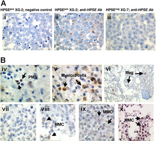 Figure 6. HPSE is expressed by BM environment cells and by a minor subpopulation of myeloma cells. (A) XG-2 and XG-7 cells were stained with control rabbit polyclonal antibodies (Abs) (i) or with a polyclonal anti-HPSE Ab at 4.5 μg/mL (ii-iii). Note the dotlike staining signal. (B) BM biopsies from patients with MM were stained with the polyclonal anti-HPSE Ab (4.5 μg/mL). (iv-vi) Environment cells in the BM of 1 patient representative of 20. PMN indicates polymorphonuclear cell; Meg, megakaryocyte. (vii-x) Heterogeneous HPSE expression among MMCs in the bone marrow of 4 representative patients (vii, patient 1; viii, patient 4; ix, patient 11; x, patient 20; see Table 2). The brown reaction product indicates the location of polyclonal Ab against HPSE. Original magnification, × 1000 (× 200 in vi).