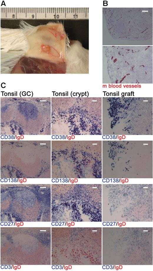 Figure 1. Human PCs and T cells persist within tonsil grafts. Immunohistochemistry was used to assess the cellular composition of tonsil grafts recovered at 4 weeks after surgery. (A) Postmortem examination of a xenochimeric mouse at 2 weeks after surgery showing vascularization of tonsil grafts. (B) Staining of tonsil grafts for expression of mouse (m) blood vessels; lower panel shows enlarged view of upper panel; scale bar represents 200 μm. (C) Serial sections of tonsil (before surgery) and tonsil graft (4 weeks after surgery) were stained for expression of human IgD (in red) and human CD38, CD138, CD27, and CD3 (in blue). Scale bar represents 200 μm (left-hand panels) and 60 μm (central and right-hand panels). Staining is representative of 10 tonsils and tonsil grafts.