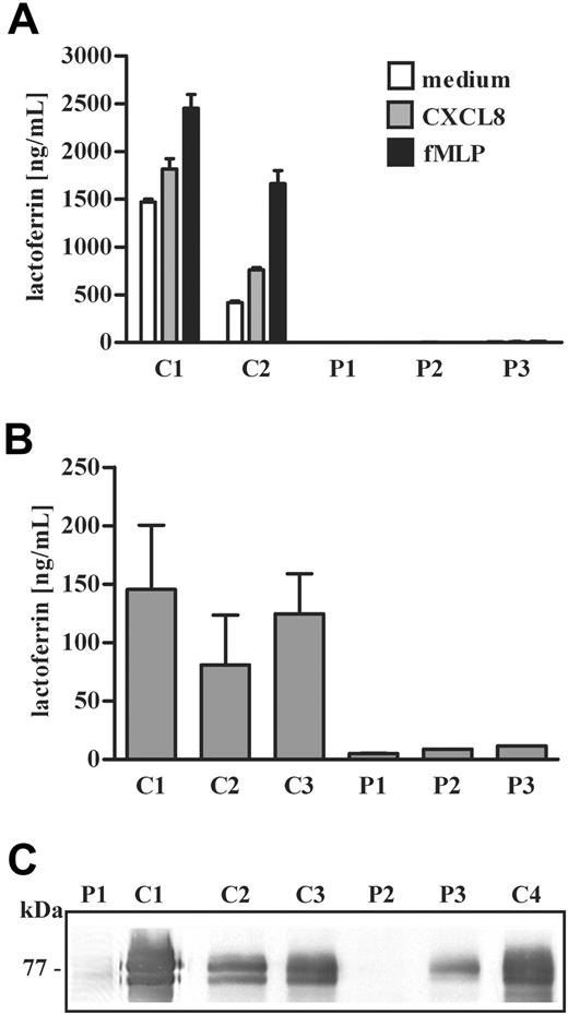 Figure 3. Lactoferrin expression and release in neutrophils of SCN patients undergoing treatment with G-CSF. (A) Neutrophils isolated from patients 1, 2, and 3 (P1, P2, and P3) were stimulated with fMLP (10 nM), CXCL8 (10 ng/mL), or medium alone for 15 minutes. In the collected supernatants, lactoferrin concentration was determined by ELISA and expressed as average + SD of 2 distinct experiments. Statistical analysis demonstrates that the amount of lactoferrin released in supernatants derived from SCN patients is significantly lower than lactoferrin detected in supernatants from control subjects (P < .05). (B) Lactoferrin concentration in plasma of SCN patients (P1, P2, and P3) was determined in at least 3 samples. Average + SD of 3 distinct determinations is presented on y-axis. Statistical analysis demonstrates that the amount of plasma lactoferrin is lower in SCN patients compared with healthy subjects (P < .05). (C) The Western blot shown in Figures 1B and 2B has been reprobed with a specific anti–human lactoferrin antibody as described in “Patients, materials, and methods.”