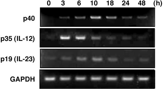 Figure 2. Transcription of IL-12–related molecules in LPS-stimulated BMMCs. RT-PCR analysis of p40, p35, and p19 after LPS stimulation for 0 to 48 hours. BMMCs were stimulated with 1 μg/mL LPS after the cells were preincubated with 100 U/mL IFN-γ for 16 hours. Equality of the RT reaction of isolated RNA was confirmed by amplification of the housekeeping gene GAPDH. These results are representative of 3 independent experiments that had similar results.