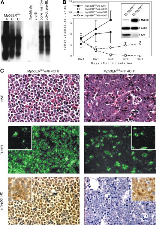 Figure 1. Molecular and cellular analyses of p53ERTAM lymphomas. (A) Analysis of tumor clonality through PCR amplification and detection of D-J junctions by Southern blotting. A, B, and C refer to 3 independent p53ERTAM tumors. gDNAs from rodent fibroblasts and pro-B cells without D-J rearrangements were used as negative controls. gDNAs from total bone marrow and a previously characterized Myc-induced polyclonal lymphoma were used as positive controls. (B) Tumor volumes versus days of 4OHT treatment. Plots with squares and circles refer to Mp53ERSEN and Mp53ERRES tumors, respectively. Solid lines/filled symbols and dashed lines/open symbols refer to untreated and 4OHT-treated mice, respectively. Error bars represent SD. The inset depicts immunoblotting on Mp53ERSEN and Mp53ERRES cells, using anti-Arf and anti-Mdm2 antibodies. β-Actin was used as a loading control. (C, top) Histologic staining of representative specimens from panel B. Tissues were harvested 3 hours after the commencement of 4OHT treatment. (Middle) TUNEL staining of adjacent sections. (Bottom) Immunohistochemical staining for p53. Brown color refers to p53 expression, and blue color is counterstaining with hematoxylin. In the last 4 panels, insets represent tumors from untreated animals. Sections were analyzed using Axioskop 40 microscope (Carl Zeiss, Maple Grove, MN) equipped with a 20×/0.45 NA Achroplan objective lens and 10× eyepieces. Images were captured using Evolution QEi camera (MediaCybernetics, Houston, TX) and Phase 3 ImagePro software (Imaging Systems, Bridgewater, NJ) and further processed using Adobe Photoshop CS v8.0 (Adobe Systems, San Jose, CA).