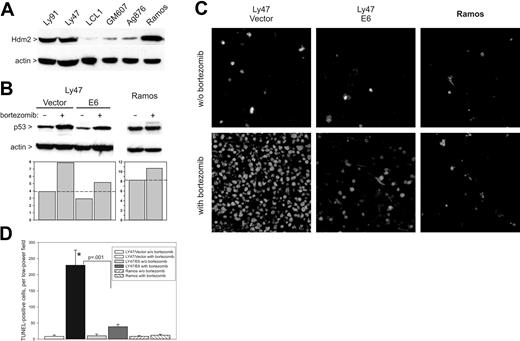 Figure 5. Elicitation of apoptotic responses in BLs by bortezomib. (A) Immunoblotting detecting Hdm2 levels in lysates of BL Ly 91, Ly47, Ag876, and Ramos, and lymphoblastoid cell lines GM607 and LCL1. (B) Immunoblotting detecting p53 levels in Ly47 and Ramos cells in vitro. Ly47 cells were additionally infected with either empty vector or the E6-encoding retrovirus. Bar graphs below blots represent quantitation of p53-specific bands. (C) TUNEL staining of Ly47 and Ramos tumors from mice treated with bortezomib or vehicle alone. (D) Quantitation of tumor cell apoptosis. Bars refer to average numbers of TUNEL+ cells per microscopic field. No less than 4 fields were counted for each tumor specimen. Error bars represent SD. The asterisk refers to a statistically significant difference in apoptosis between Ly47/vector and Ly47/E6 tumors.