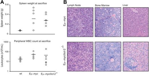 Figure 7. Loss of endogenous Bcl-2 does not reduce the severity of Eμ-myc lymphoma. (A) Comparison at time of death of spleen weights (g) from moribund Eμ-myc (n = 8), Eμ-myc/bcl-2−/− (n = 10), and normal control (wt) reconstituted mice (n = 4), and of peripheral leukocyte cellularity (× 106 cells/mL) from moribund Eμ-myc (n = 8), Eμ-myc/bcl-2−/− (n = 9), and normal control (wt) (n = 9) reconstituted mice. Bars indicate the mean values. (B) Hematoxylin/eosin staining of representative LN (×40), bone marrow (×20), and liver (×20) sections taken from terminally ill Eμ-myc and Eμ-myc/bcl-2−/− reconstituted animals. Images were visualized using an Olympus BX50 microscope (Olympus, Tokyo, Japan) equipped with a 40×/0.85 NA or a 20×/0.5 NA objective. Images were photographed with an Olympus U-HAD3 digital camera and recorded using Axiovision 4.2 software (Carl Zeiss, Thornwood, NY). Images were processed with Adobe Photoshop CS2 software, version 9.0 (Adobe Systems, San Jose, CA).