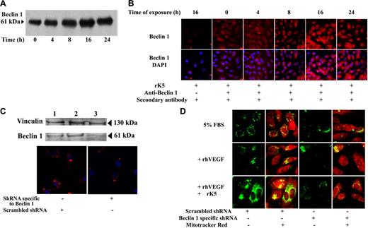 Figure 5. rK5-induced autophagy is Beclin 1 dependent. (A) Representative immunoprecipitation of Beclin 1 in rK5-treated HUVECs. Cell lysates (200 μg/mL) collected at different time points were immunoprecipitated by anti–Beclin 1 antibody and blotted with anti–Beclin 1 antibody. (B) Confocal microscopy images of HUVECs showing endogenous Beclin 1 levels at different time points after rK5 treatment. Nuclei were labeled by DAPI. Beclin 1 expression (red) was detected using an anti–Beclin 1 monoclonal antibody. Alexa Fluor 647 goat anti–mouse IgG was used as secondary antibody. rK5-treated HUVEC (16 hours) sample without the primary antibody treatment was used as a negative control. (C) HUVECs were grown to subconfluent conditions. Scrambled shRNA or shRNA specific to Beclin 1 were transfected using Lipofectamine 2000. Top row shows total-cell lysates of untransfected HUVECs (lane 1), scrambled shRNA-transfected HUVECs (lane 2), and shRNA specific to Beclin 1–transfected HUVECs (lane 3) that were analyzed to determine Beclin 1 levels by Western blot. Bottom row shows confocal images of shRNA-transfected HUVECs showing Beclin 1 levels (red) 36 hours after transfection. Nuclei were stained with DAPI (blue). (D) HUVECs were cotransfected with LC3-GFP (green) and shRNA. Transfected HUVECs were cultured in 5% FBS in M199 with or without 40 ng/mL VEGF. Scrambled shRNA and shRNA specific to Beclin 1–transfected cells were exposed to 1.5 μg/mL rK5 for 24 hours. Treated HUVECs were labeled with Mitotracker Red. Confocal microscopy images were obtained at 600× magnification.