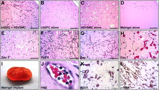 Figure 2. In vivo vasculogenic potential of EPCs. Matrigel implants containing cbEPCs and/or HSVSMCs evaluated after one week. (A) H&E staining of implants (×100) containing a combination of cbEPCs (passage 6) and HSVSMCs, (B) only cbEPCs, (C) only HSVSMCs, (D) and Matrigel alone. H&E staining of implants containing both cbEPCs and HSVSMCs evaluated at day 2 (E), day 4 (F), and day 7 (G, ×100; H, ×400) after xenografting. (I-L) Matrigel plug containing cbEPCs and HSVSMCs harvested one week after implantation. (I) Macroscopic view of explanted Matrigel plug. (J) H&E staining showing high-power view of one microvessel containing hematopoietic cells. (K) Immunohistochemical staining at one week with human-specific CD31 antibody (×400) and with (L) α-SMA antibody. All images are representative of implants harvested from 4 different animals. (Black scale bar represents 250 μm; white scale bar, 50 μm.)