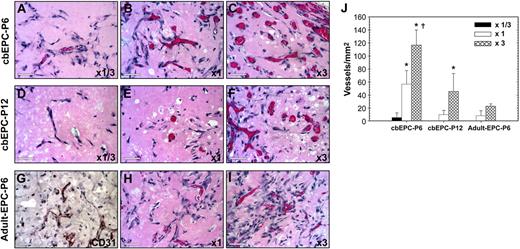 Figure 6. Effect of implanted cell number on vasculogenic performance of EPCs. Matrigel implants containing either 0.5 × 106 (× 1/3) (A,D), 1.5 × 106 (× 1) (B,E,H), or 4.5 × 106 (× 3) (C,F,I) EPCs in the presence of HSVSMCs (4:1 EPCs/HSVSMCs ratio) were evaluated after one week. (A-C) H&E staining of Matrigel implants containing cbEPCs at passage 6 (× 400); (D-F) cbEPCs at passage 12 (× 400); and (G-I) adult EPCs at passage 6 (× 400). (G) Anti–human CD31 immunostained section of adult EPCs at passage 6 seeded at × 3. All images are representative of implants harvested from 4 different animals (scale bar represents 50 μm). (J) Microvessel density was quantified by counting lumenal structures containing red blood cells. Each bar represents the mean microvessel density value determined from 4 separated implants and animals ± SD. *P < .05 compared with × 1/3. †P < .05 compared with × 1.
