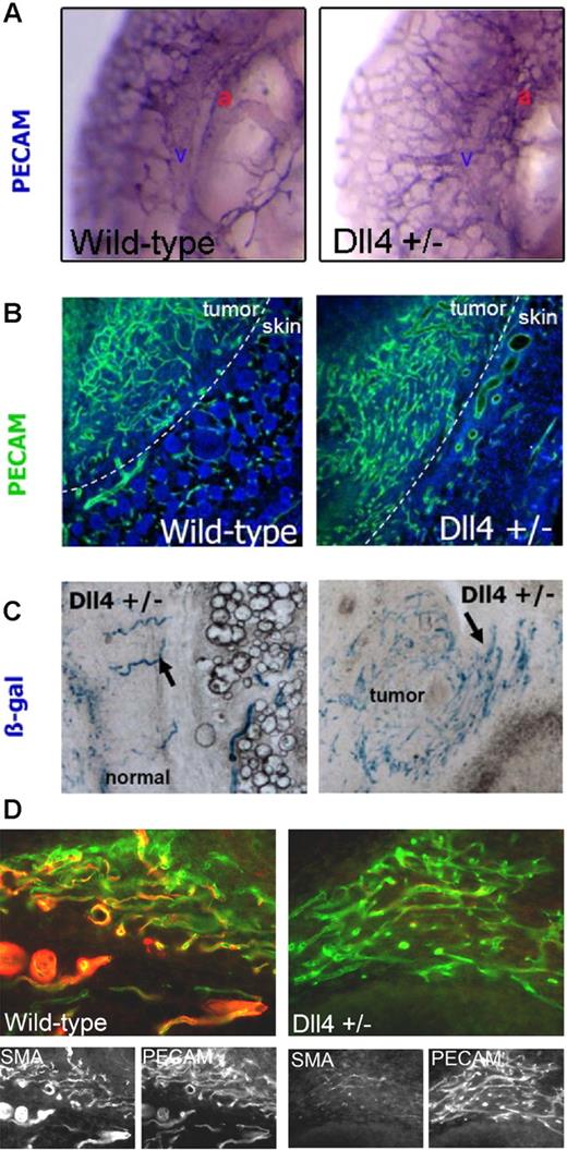 Figure 1. Dll4+/− mutant mice show defective increase in vascular proliferation. (A) The vasculature of wild-type and Dll4+/− embryos were examined using PECAM whole-mount immunostaining. Dorsal aorta and cardinal vein are labeled as a and v, respectively. Absence of large vessels and an increase in vessel branching and density was seen in Dll4+/− embryos at E10.5 compared to wild type. (B) Vascular response in Dll4+/− adult mice was examined as in panel A after tumor implantation. Wild-type mice showed organized vascular proliferation in the tumor (left half), while mutant mice showed markedly increased vascular response that lacks organization and vascular hierarchy. (C) Expression of Dll4 in tumor and normal regions in Dll4+/− mutant mice was examined by β-gal staining. Dll4 expression was observed (arrows) in a few discrete vessels in the normal tissue, while the tumor region showed many β-gal–positive vessels of similar appearance indicative of Dll4 induction in tumor vessels. (D) Pericyte coverage around newly forming vessels was examined by α-SMA localization. In wild-type mice, the vessels showed colocalization of PECAM and α-SMA (left panel). In Dll4+/− mice tumor vessels, however, the number of α-SMA–positive cells lining the endothelial cells was profoundly reduced (right panel). Images in panel A were viewed under an Olympus SZX12 stereomicroscope (Tokyo, Japan) with Leica PL Fluotar 0, 5, 20×/0.5 NA dry objective (Wetzlar, Germany), captured with an Olympus C4040 camera, and processed with Olympus DP-Soft 3.2. Images in panels B-D were viewed under a Leica DMRA2 fluorescence microscope with Leica HC PL Fluotar 0, 5, 20×/0.5 NA dry objective, captured using Photometrics CoolSNAP HQ, (Photometrics, Friedland, Denmark), and processed with Metamorph 4.6-5 (Molecular Devices, Sunnyvale, CA).