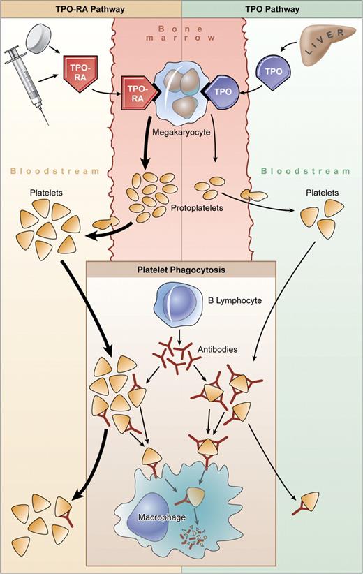Thrombopoietin receptor agonists in ITP. Platelet production in patients with ITP is variable. Megakaryopoiesis may be impaired by antibody, and platelets are destroyed by macrophages within the spleen and elsewhere, perhaps including the bone marrow. Plasma levels of TPO are normal or only slightly increased in patients with ITP, and hepatic production is insufficient to overcome antibody-mediated platelet destruction. Megakaryocytes stimulated with TPO receptor agonists (TPO-RAs) generate platelets in greater numbers, which may also lessen sensitization with antibody and reduce both peripheral clearance and perhaps intramedullary destruction. Illustration by Kenneth Probst.