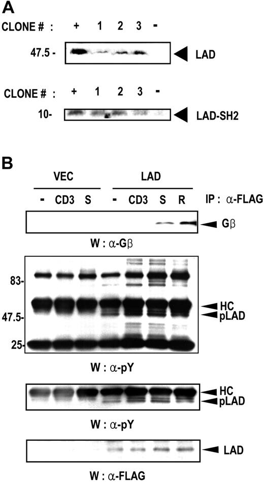 Figure 2. Lad associates with Gβ in T cells upon chemokine treatment. (A) Establishment of Jurkat T-cell clones that stably express FLAG-tagged full-length Lad (Lad) or Lad-SH2 domain (Lad-SH2). Three independent clones were selected for each transfectant, and the expression of the transfected genes was assayed by Western blotting with anti-FLAG antibody. The positive control (+) is the lysate of Cos7 cells transfected with expression plasmids encoding Lad or Lad-SH2 domain. The negative control (−) is the lysate of untransfected COS7 cells. (B) Lad associates with Gβ in T cells upon chemokine treatment. Jurkat T cells that stably express full-length Lad were activated with anti-CD3ϵ antibody (CD3), SDF-1α (S), or RANTES (R) for 10 minutes. The cell lysates were then subjected to immunoprecipitation with anti-FLAG antibody and Western blotting with anti-Gβ antibody (upper panel). The same precipitates were also analyzed by Western blotting with anti-phosphotyrosine (α-pY) antibody (middle panels) or anti-Flag antibody (lower panel). To visualize the phosphorylated Lad band more clearly, another panel from a shorter exposure of the same blot around the phosphorylated Lad band is shown below middle panel. pLAD indicates phosphorylated Lad; HC, IgG heavy chain