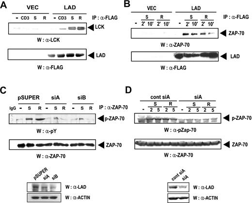Figure 4. Lad associates with Lck and Zap-70 in response to chemokine treatment. (A) Lck associates with Lad upon chemokine treatment. Jurkat T cells that stably express Lad-FLAG (Lad) or were transfected with empty vector (Vec) were activated with anti-CD3 antibody (CD3), SDF-1α (S), or RANTES (R) for 10 minutes. The cell lysates were then subjected to immunoprecipitation with 5 μg antiFLAG antibody, and the precipitates were analyzed by immunoblotting with antiLck antibody (upper panel). The membrane was reprobed with the anti-FLAG Ab (bottom panel). (B) Zap-70 associates with Lad upon chemokine treatment. Jurkat T cells were transfected with pcDNA3.1 or the expression plasmid encoding Lad-FLAG. These cells were then stimulated for the indicated periods with SDF-1α (S) or RANTES (R), after which the cell lysates were subjected to immunoprecipitation with an anti-FLAG antibody and subsequent immunoblotting with anti–Zap-70 antibody (top panel). The membrane was reprobed with the anti-FLAG Ab (bottom panel). (C) The chemokine-dependent phosphorylation of Zap-70 is repressed by expressing hLad siRNA. Jurkat T cells were transfected with empty pSUPER or pSUPER plasmids expressing SiA or SiB and stimulated with SDF-1α (S) or RANTES (R). The cell lysates were then analyzed by immunoprecipitation with anti–Zap-70 antibody and subsequent immunoblotting with anti-phosphotyrosine antibody (4G10) (top panel). The blot was also probed with the anti–Zap-70 antibody (bottom panel). (D) Jurkat T-cell clones that stably express CCR5 were transfected with pSUPER plasmids expressing control siA or siA and stimulated with SDF-1α or RANTES. The cell lysates were analyzed by Western with anti–phosphoZap-70 (Tyr493) or anti–Zap-70 Abs.