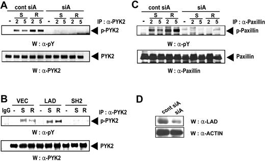 Figure 6. Lad is required for the chemokine-induced activation of focal adhesion molecules such as Pyk2 and paxillin. (A) Jurkat T-cell clones expressing CCR5 were transfected with pSUPER plasmids expressing control siA or siA and treated with SDF-1α (S) or RANTES (R) for 2 or 5 minutes. Pyk2 was immunoprecipitated and the immunoprecipitates were analyzed by immunoblotting with anti-phosphotyrosine or anti-Pyk2 antibody. IgG was used as a negative control. (B) Jurkat T cells stably expressing Lad or the SH2 domain of Lad were treated with SDF-1α or RANTES and processed as described in panel A. (C) The cell lysates prepared as described in panel A were analyzed by immunoprecipitation with anti-paxillin antibody and subsequent immunoblotting with anti-phosphotyrosine antibody (4G10) (upper panel). As a protein-loading control, the blots were reprobed with anti-paxillin antibody (lower panel). (D) The same cell lysates used in panel A were analyzed for the Lad levels by Western blotting with anti-Lad antibody (upper panel) and with anti-actin antibody (lower panel).