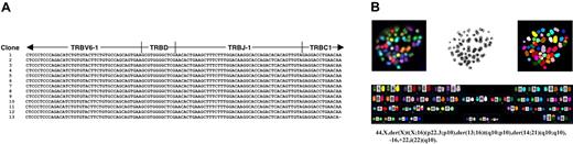 Figure 4. LC15 is a clonal population. (A) Alignment of VDJ junctional regions of TRBV6-1 sequences amplified from LC15 by 5′-RACE, demonstrating that LC15 expresses a single, unique TCR β-chain. (B) A spectral karyotype of LC15 demonstrates 4 translocations; all autosomal breaks occurred at centromeres. These were clonal abnormalities.